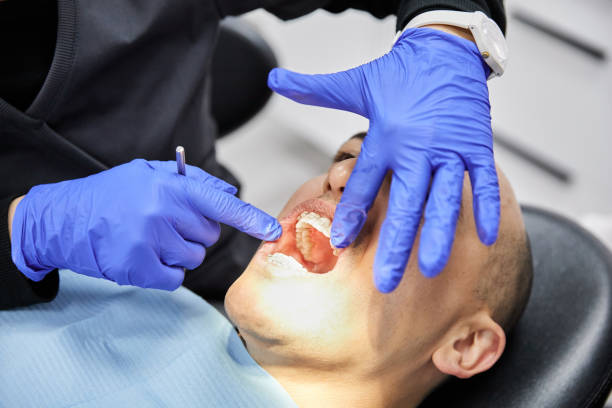 Best Broken Tooth Emergency  in Pine Prairie, LA