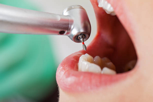 Best Affordable Emergency Dental Care  in Pine Prairie, LA